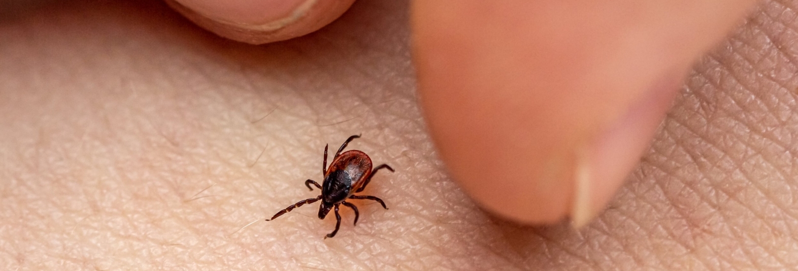 Zecker auf der Haut