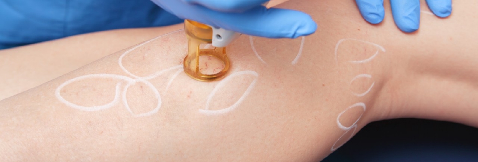 Individuelle Gesundheitsleistungen